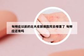 甸柳莊以前的北大皮膚病醫(yī)院去哪里了 甸柳莊還有嗎