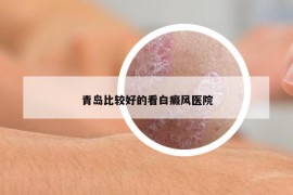 青島比較好的看白癜風(fēng)醫(yī)院
