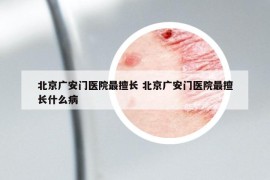北京廣安門醫(yī)院最擅長 北京廣安門醫(yī)院最擅長什么病