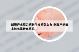 剖腹產(chǎn)術(shù)后刀疤長牛皮癬怎么辦 剖腹產(chǎn)疤痕上長毛是什么意思