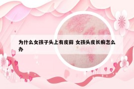 為什么女孩子頭上有皮蘚 女孩頭皮長癬怎么辦