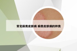 常見蘚類皮膚病 癬類皮膚病的種類