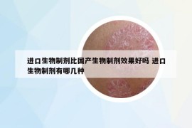 進口生物制劑比國產生物制劑效果好嗎 進口生物制劑有哪幾種