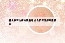 什么軟膏治癬效果最好 什么藥膏涂癬效果最好