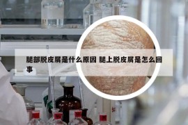 腿部脫皮屑是什么原因 腿上脫皮屑是怎么回事