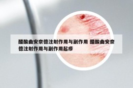 醋酸曲安奈德注射作用與副作用 醋酸曲安奈德注射作用與副作用起疹