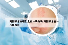 兩側(cè)眼角白眼仁上有一塊白塊 雙側(cè)眼角有一小塊發(fā)白
