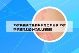 15歲男孩兩個(gè)胳膊長癬是怎么回事 15歲孩子胳膊上起小紅點(diǎn)兒的原因