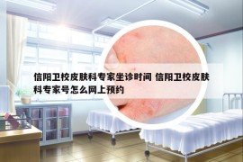 信陽衛(wèi)校皮膚科專家坐診時間 信陽衛(wèi)校皮膚科專家號怎么網(wǎng)上預(yù)約