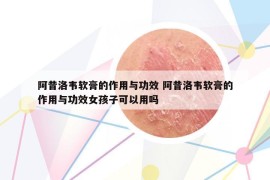 阿昔洛韋軟膏的作用與功效 阿昔洛韋軟膏的作用與功效女孩子可以用嗎