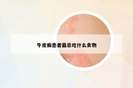 牛皮癬患者最忌吃什么食物