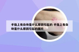 手指上有白塊是什么原因引起的 手指上有白塊是什么原因引起的圖片