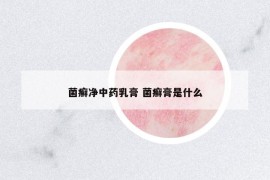 菌癬凈中藥乳膏 菌癬膏是什么