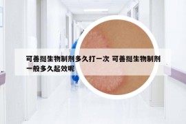 可善挺生物制劑多久打一次 可善挺生物制劑一般多久起效呢