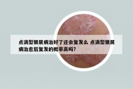 點滴型銀屑病治好了還會復(fù)發(fā)么 點滴型銀屑病治愈后復(fù)發(fā)的概率高嗎?