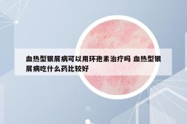 血熱型銀屑病可以用環(huán)孢素治療嗎 血熱型銀屑病吃什么藥比較好
