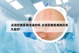 點(diǎn)滴型銀屑病泡澡好嗎 點(diǎn)滴型銀屑病用藥多久能好