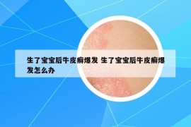 生了寶寶后牛皮癬爆發(fā) 生了寶寶后牛皮癬爆發(fā)怎么辦
