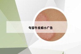 句容牛皮癬小廣告