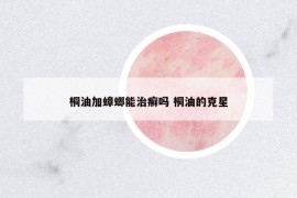 桐油加蟑螂能治癬嗎 桐油的克星