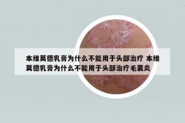 本維莫德乳膏為什么不能用于頭部治療 本維莫德乳膏為什么不能用于頭部治療毛囊炎