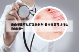 云南哪里可以打生物制劑 云南哪里可以打生物制劑針
