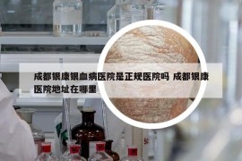 成都銀康銀血病醫(yī)院是正規(guī)醫(yī)院嗎 成都銀康醫(yī)院地址在哪里