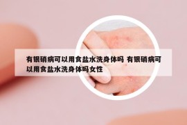有銀硝病可以用食鹽水洗身體嗎 有銀硝病可以用食鹽水洗身體嗎女性