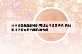 吃枸櫞酸托法替布片可以治療銀屑病嗎 枸櫞酸托法替布片的副作用大嗎