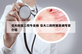 交大附屬二院牛皮癬 交大二附院銀屑病專家介紹