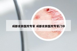 成都皮膚醫(yī)院專家 成都皮膚醫(yī)院專家門診