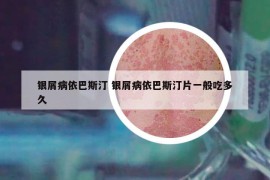 銀屑病依巴斯汀 銀屑病依巴斯汀片一般吃多久