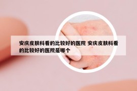 安慶皮膚科看的比較好的醫(yī)院 安慶皮膚科看的比較好的醫(yī)院是哪個(gè)
