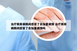 治療銀屑病期間感冒了會(huì)加重病情 治療銀屑病期間感冒了會(huì)加重病情嗎