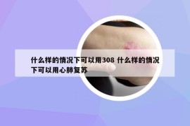什么樣的情況下可以用308 什么樣的情況下可以用心肺復蘇