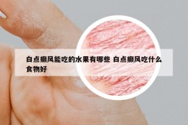 白點(diǎn)癲風(fēng)能吃的水果有哪些 白點(diǎn)癲風(fēng)吃什么食物好