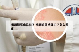 喝酒銀屑病又犯了 喝酒銀屑病又犯了怎么回事