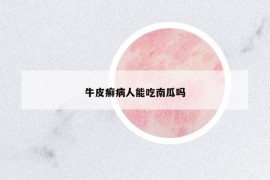 牛皮癬病人能吃南瓜嗎