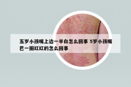 五歲小孩嘴上邊一半白怎么回事 5歲小孩嘴巴一圈紅紅的怎么回事