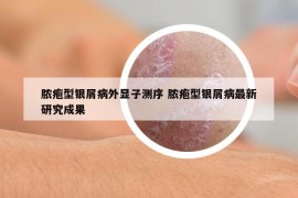 膿皰型銀屑病外顯子測(cè)序 膿皰型銀屑病最新研究成果