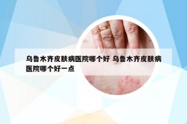 烏魯木齊皮膚病醫(yī)院哪個好 烏魯木齊皮膚病醫(yī)院哪個好一點