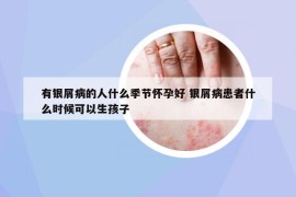 有銀屑病的人什么季節(jié)懷孕好 銀屑病患者什么時(shí)候可以生孩子