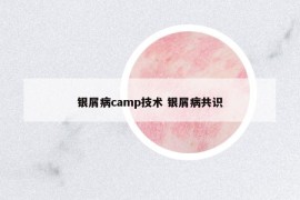 銀屑病camp技術(shù) 銀屑病共識