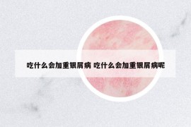 吃什么會(huì)加重銀屑病 吃什么會(huì)加重銀屑病呢