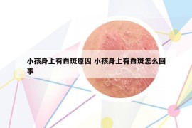 小孩身上有白斑原因 小孩身上有白斑怎么回事
