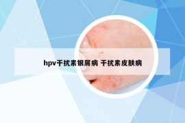 hpv干擾素銀屑病 干擾素皮膚病