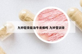 九妙輕膏能治牛皮癬嗎 九妙瑩潤(rùn)膏