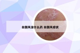 白顫風涂什么藥 白顫風癥狀
