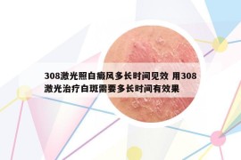 308激光照白癜風(fēng)多長(zhǎng)時(shí)間見(jiàn)效 用308激光治療白斑需要多長(zhǎng)時(shí)間有效果