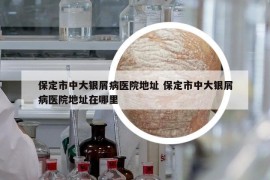 保定市中大銀屑病醫(yī)院地址 保定市中大銀屑病醫(yī)院地址在哪里